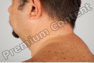 Neck 3D scan texture 0007